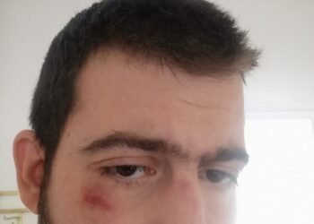 Napad na glavnog urednika