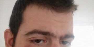 Napad na glavnog urednika